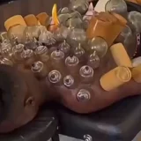 André Onana Shares Cupping Therapy Recovery Routine at Trabzonspor