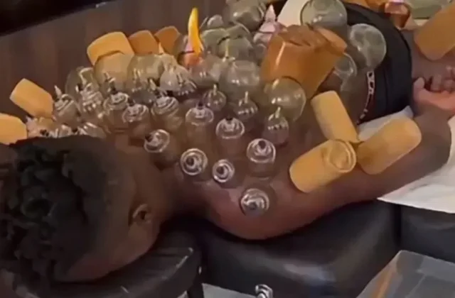 André Onana Shares Cupping Therapy Recovery Routine at Trabzonspor