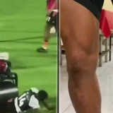 Andros Townsend Reveals Diet That Aided Steamroller Injury Recovery