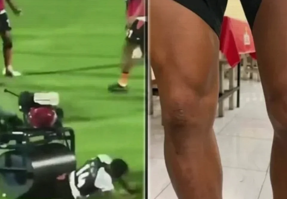 Andros Townsend Reveals Diet That Aided Steamroller Injury Recovery