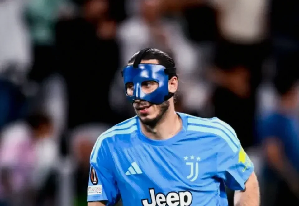 Juventus Hit by Five Player Surgeries in Troubled Start Under Spalletti