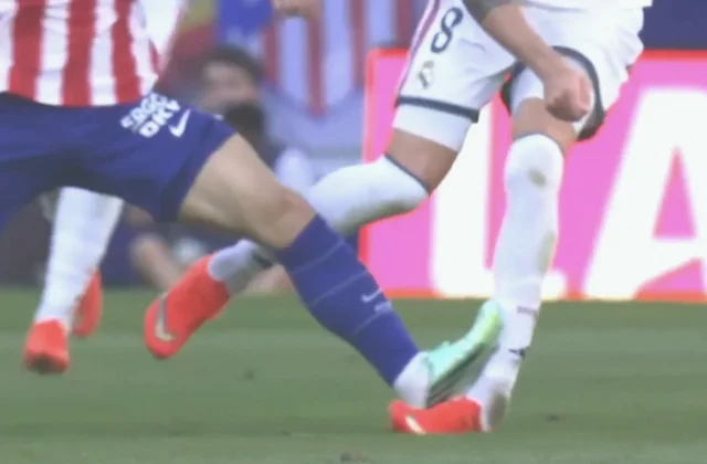 Real Madrid’s Federico Valverde Suffers Serious Ankle Injury