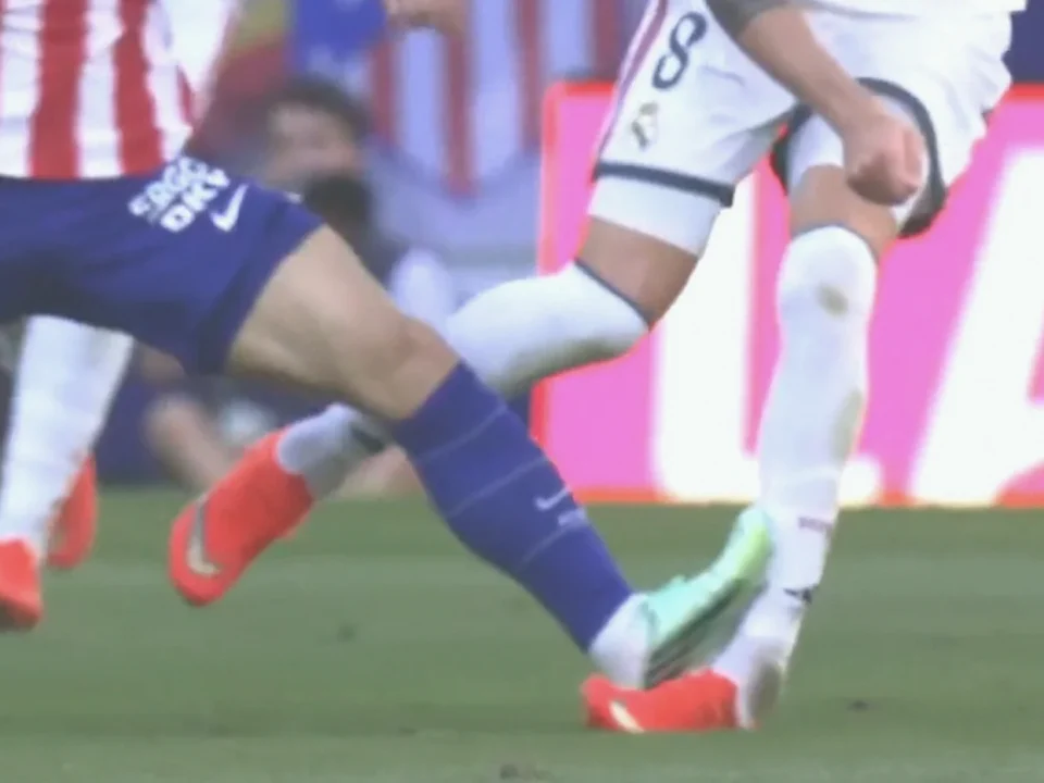 Real Madrid’s Federico Valverde Suffers Serious Ankle Injury
